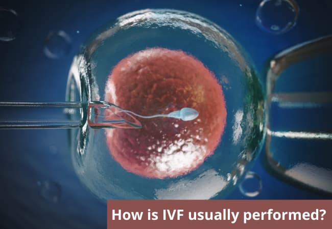 IVF సాధారణంగా ఎలా నిర్వహించబడుతుంది?